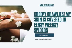 Creepy Crawlies My Skin is Covered in Eensy Weensy Spiders